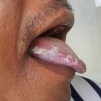 विचलित लोग